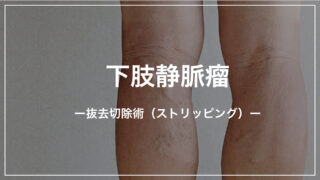 下肢静脈瘤（かしじょうみゃくりゅう）